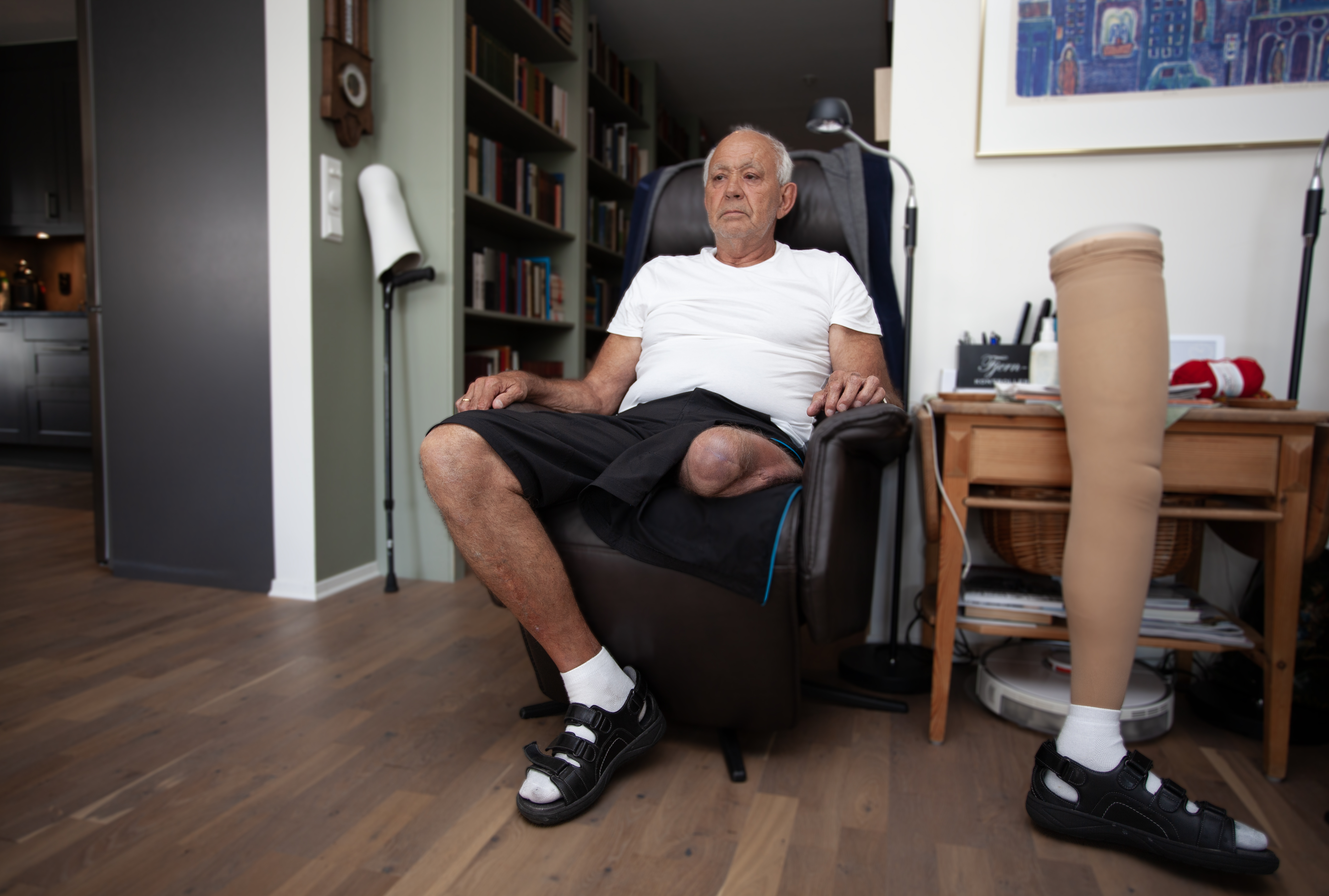 MISTET BEINET: Simen Brænden måtte amputere venstre bein over kneet etter ulykken. Brænden har i dag god bevegelighet med protese. Foto: Øyvind Henriksen
